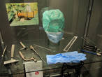 Хирургические инструменты, использующиеся при операциях по методу Илизарова.