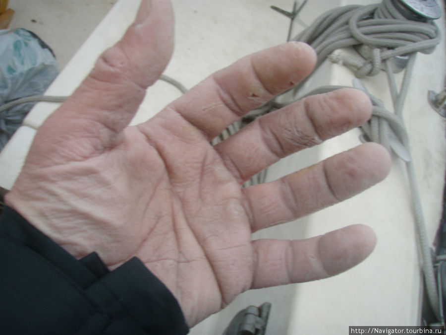 14 Декабря 2011 г. Сев.Атлантика. 
Так выглядят руки после 10-12 часов рулежки вручную...