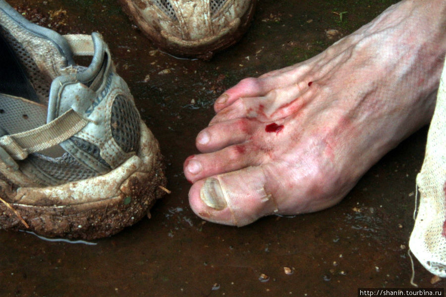 Ноги в крови — это нас пиявки покусали Кало, Мьянма